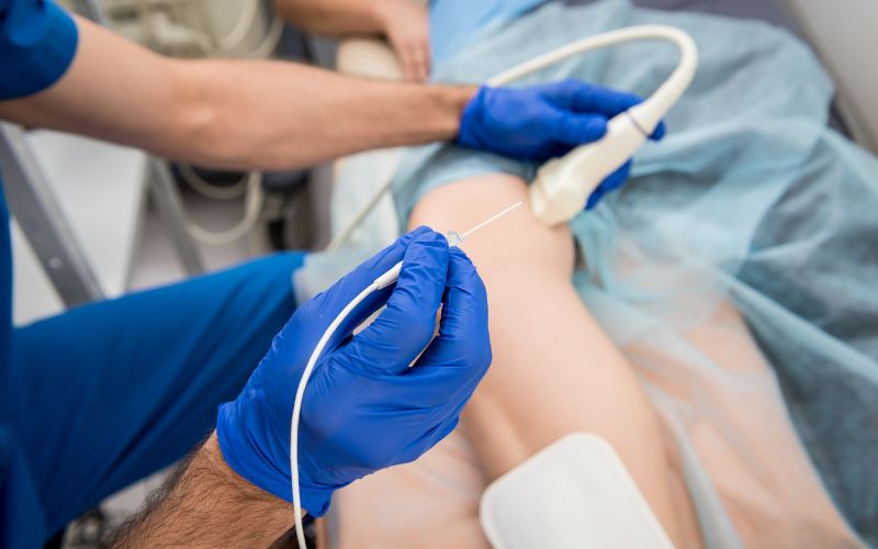 Na zdjęciu przedstawiono zabieg ablacji serca.