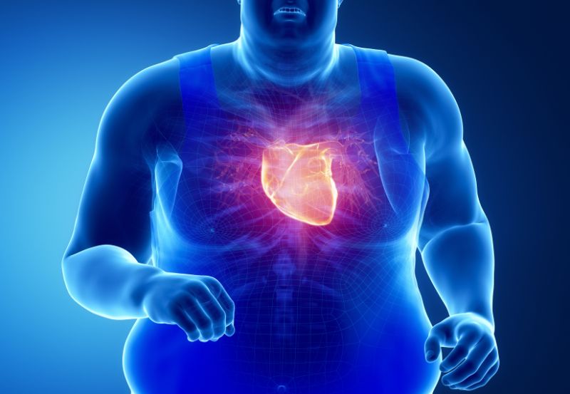 narażenie serca na zawał