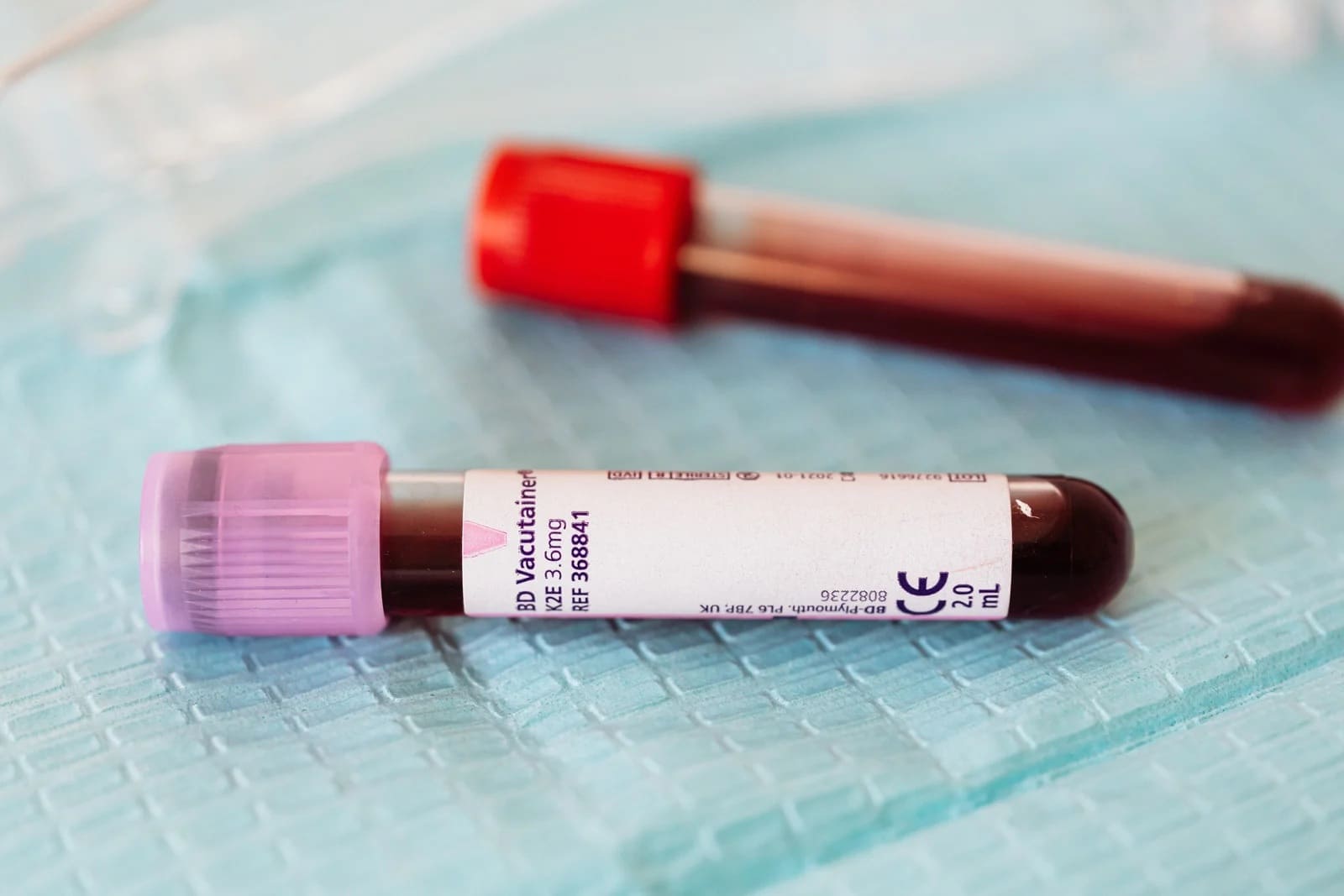 Obniżone neutrofile w morfologii – co może oznaczać wynik i co omówić z lekarzem?