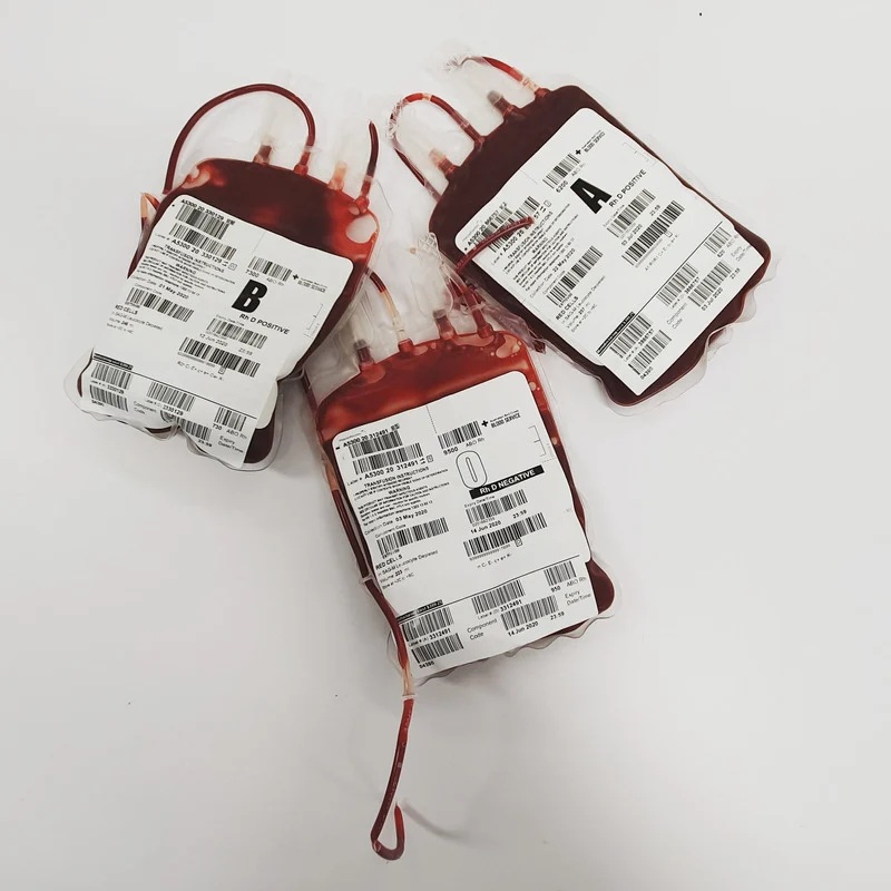 Neutrofile poniżej normy – jak interpretować wynik morfologii?
