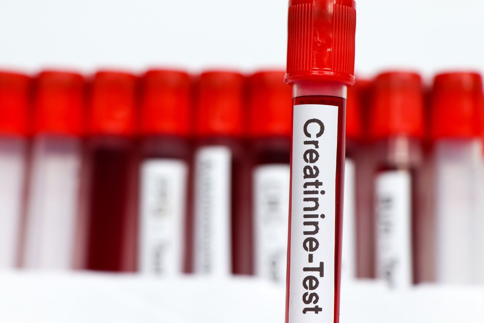 Najczęstsze przyczyny i diagnostyka ostrego uszkodzenia nerek