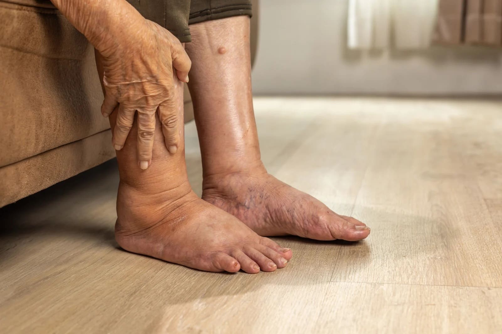 Ostre uszkodzenie nerek – pierwsze objawy i sygnały alarmowe