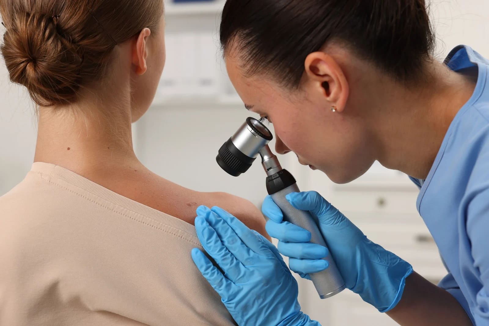 ABCDE czerniaka – jak samodzielnie oglądać znamiona i kiedy iść do dermatologa?