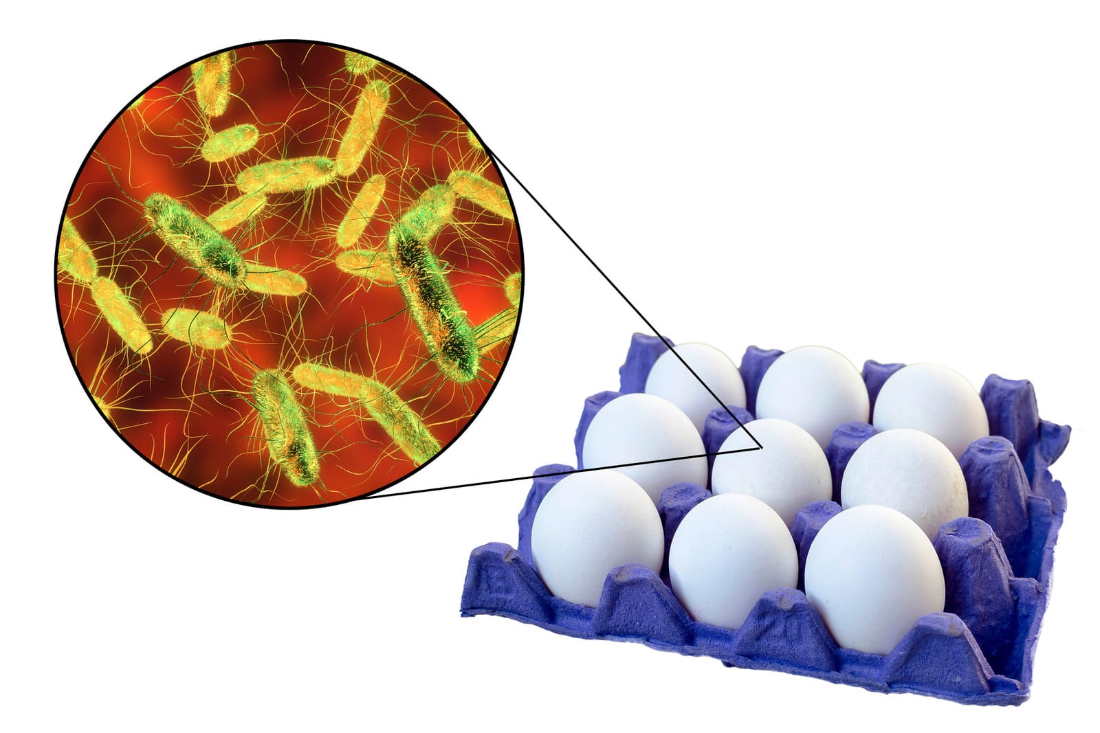 Salmonella – kiedy potrzebna jest konsultacja lekarska? Objawy, diagnostyka i leczenie