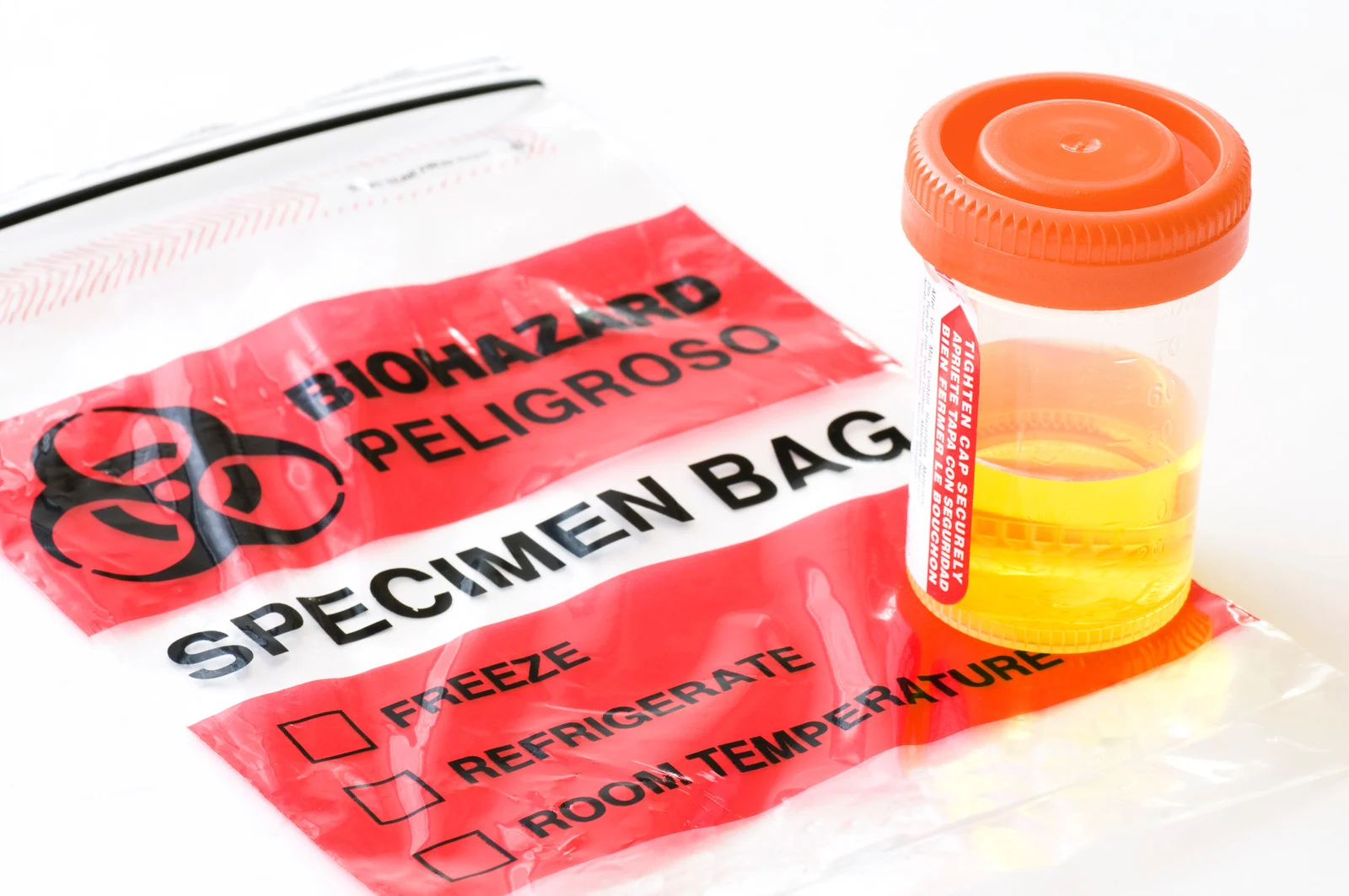 Zespół bolesnego pęcherza a ZUM – czym różnią się objawy i leczenie?