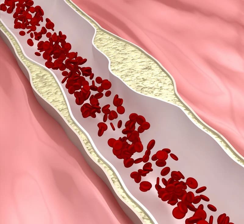 Cholesterol nie-HDL w badaniu krwi – jak interpretować wynik i kiedy skonsultować go z lekarzem?