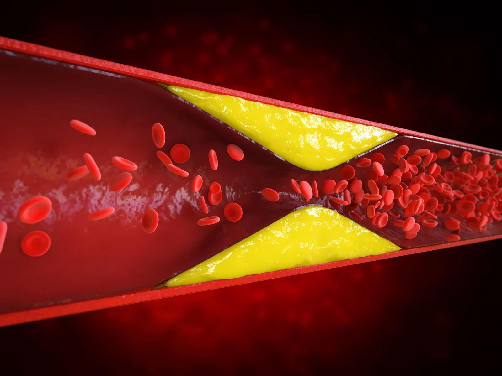 Apolipoproteina B (ApoB) – kiedy warto ją oznaczyć i co oznacza wynik?