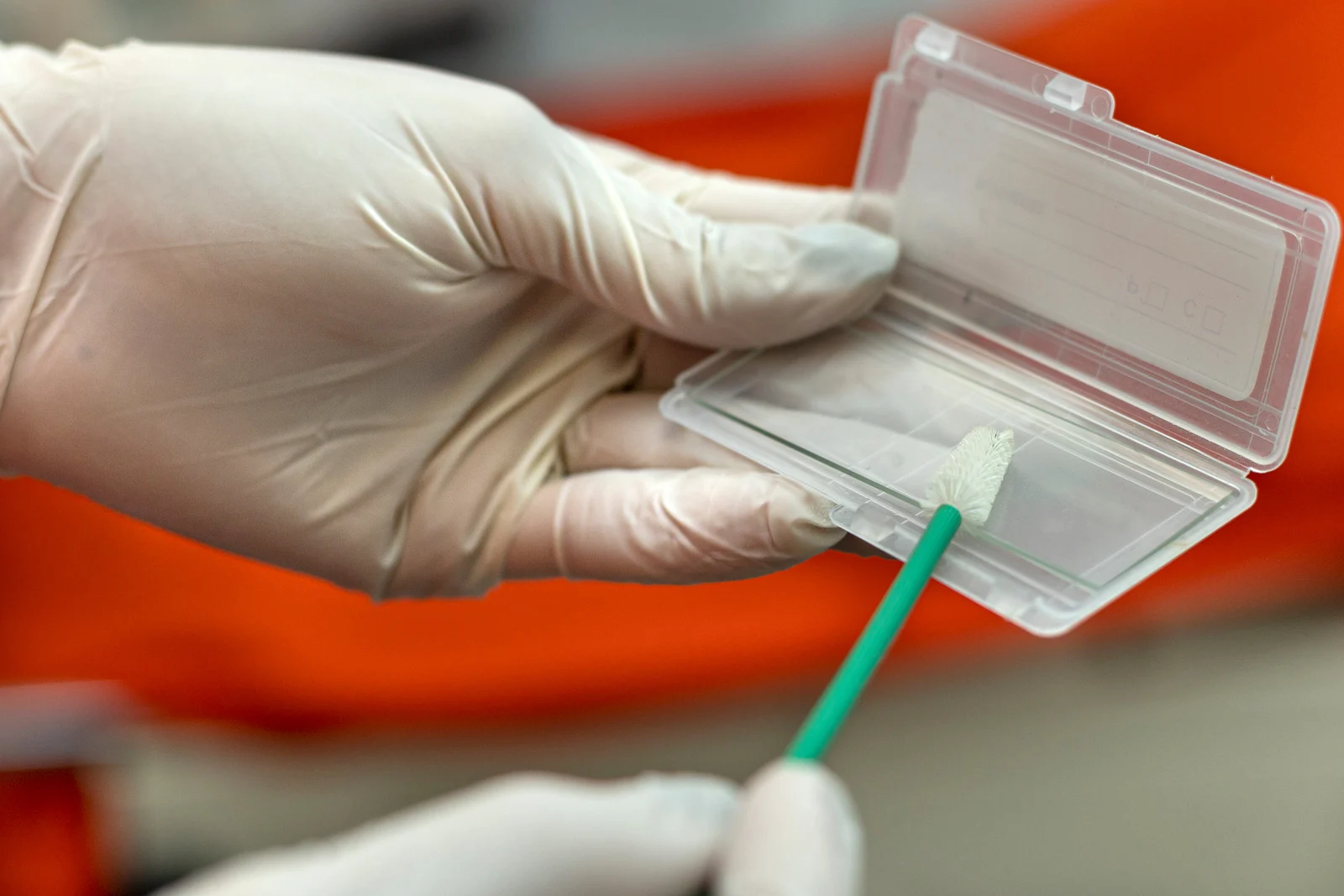 Test HPV HR i cytologia płynna – czym się różnią i jak interpretować wyniki?