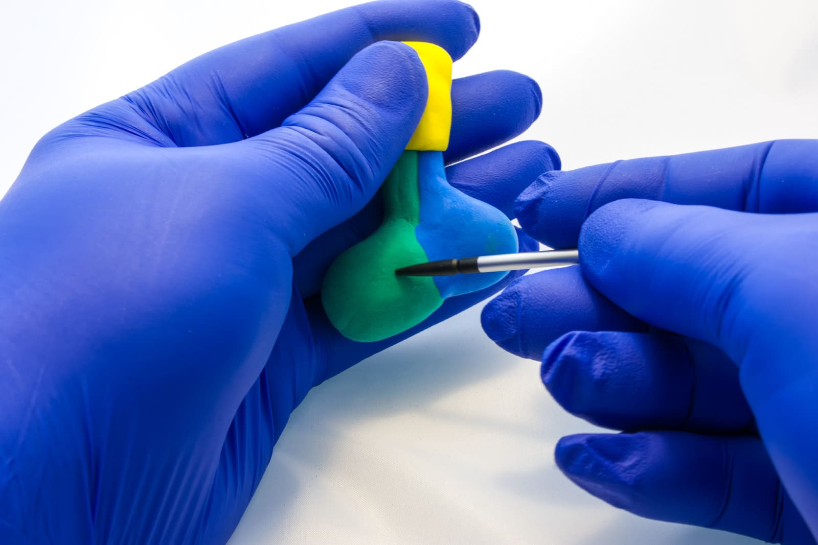 Hiperprolaktynemia – diagnostyka i leczenie